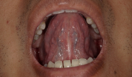 Close up of evenly spaced teeth