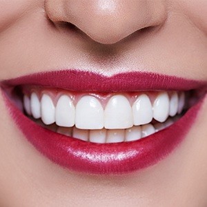 Closeup of beautiful teeth and healthy gums