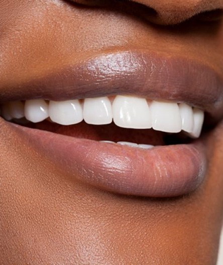 Close-up of woman’s smile with beautiful teeth