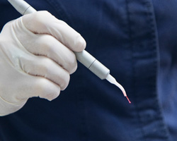 Dental team member holding laser