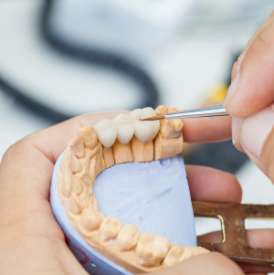 Dental ceramist adjusting a dental bridge in a model of the mouth