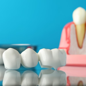 Dental bridge resting on a table