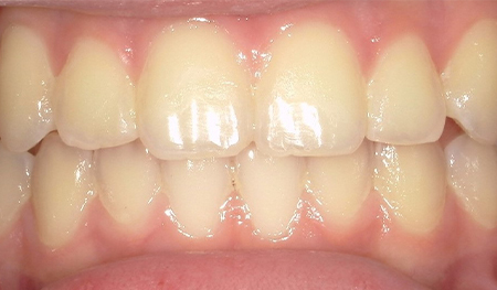 Close up of evenly spaced teeth