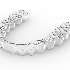 : a closeup, graphic illustration of a clear Invisalign tray