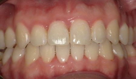 Close up of evenly spaced teeth