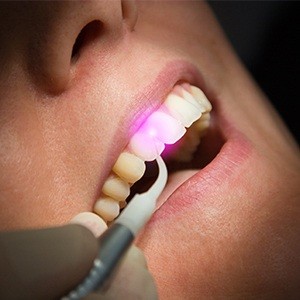 Patient receiving laser dentisty treatment